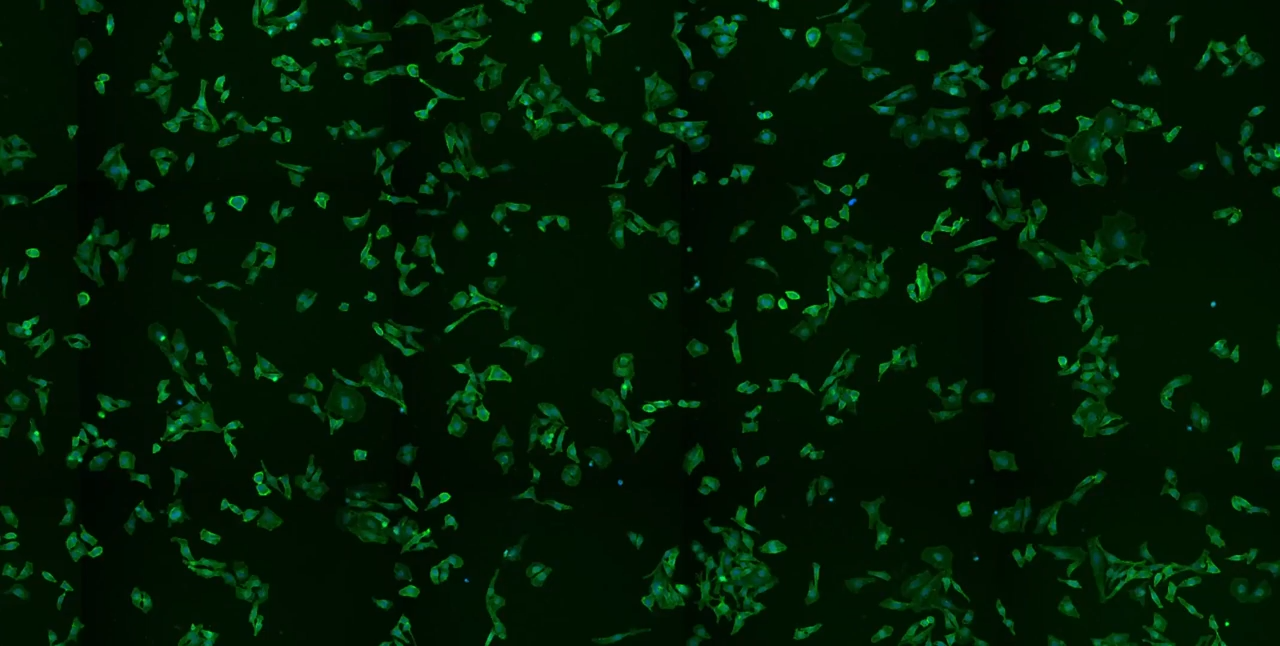 Rapid Cell Count & Classification